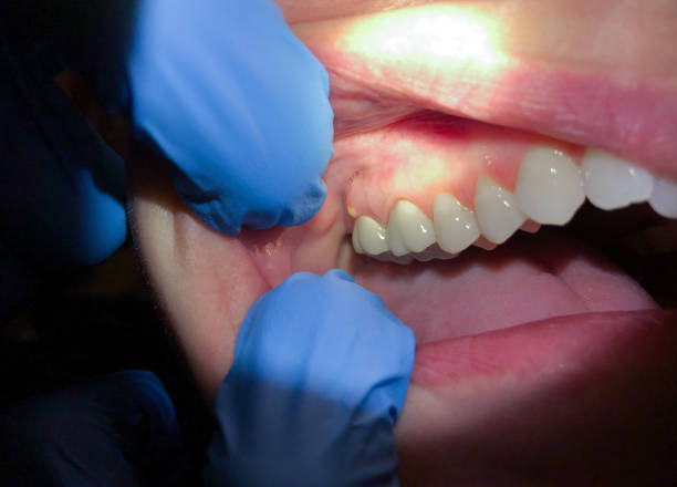 Best Teeth Whitening  in Ravenna, OH